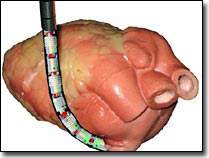 I-Snake: a revolutionary robot in medicine