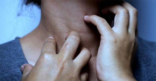 It feels like a person who is infested with insects: strange disease makes many people miserable