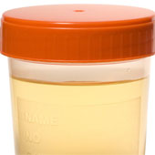 It is easy to isolate stem cells in the urine
