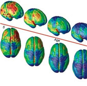 It took 25 years for the brain to develop completely