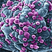 Italian scientists found metastasis in breast cancer