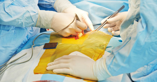 Italy performed the world's first artificial esophageal transplant