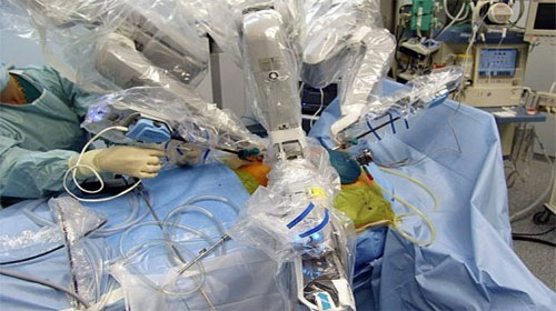 Italy successfully used pancreas implant robots