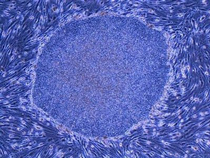 Japan creates stem cells from wisdom teeth