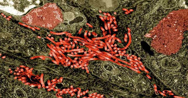 Japan has just decided to import ... Ebola and many other deadly viruses