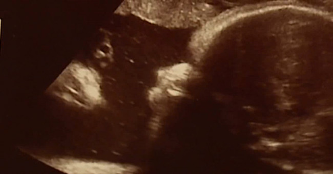 Jesus Christ appeared in the image of a baby girl soon to be born