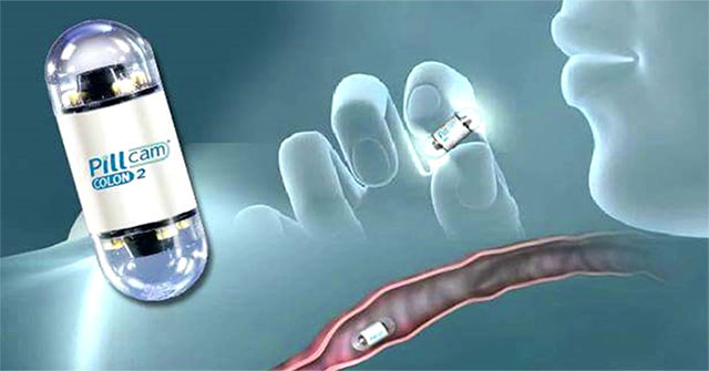 Jewish PillCam 'Capsule': 'Tiny' colonoscopy camera, cheaper than regular colonoscopy