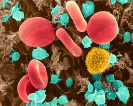 Kill the tumor with triple antibodies