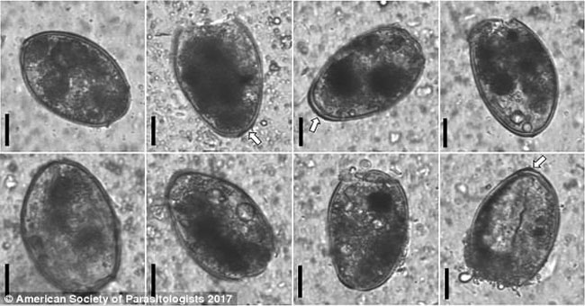 Korea: Detection of eggs in mummy liver 375 years old