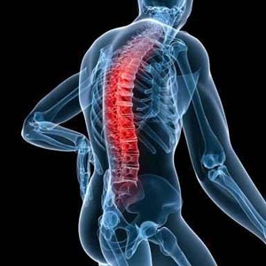 Lack of high levels of vitamin D can result in Parkinson's