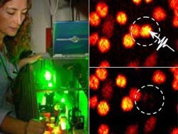 Laser knives kill every cancer cell