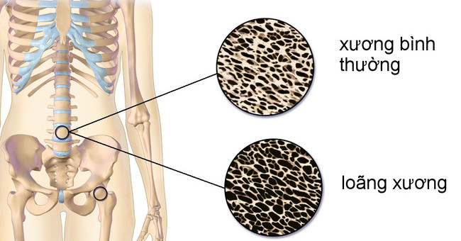 Learn about the role of vitamin K in the body