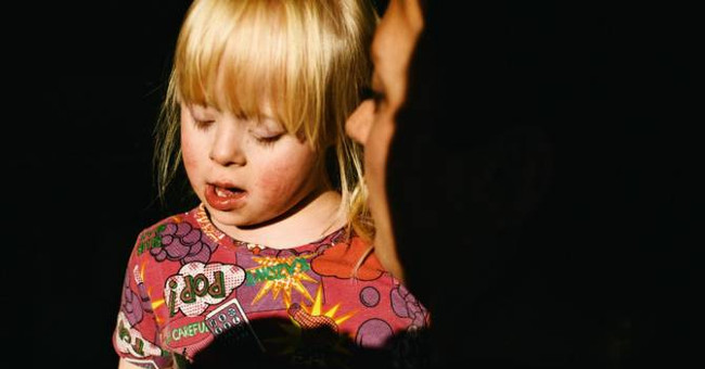 Learn Down syndrome and the truth you should know