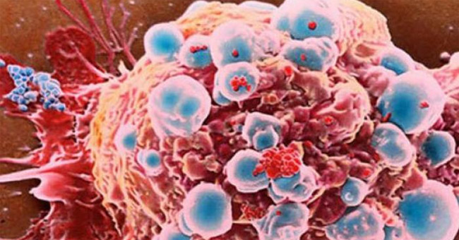 Learn some dangerous blood diseases