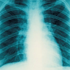 Learn the mechanism of self-regenerating bone right in the body