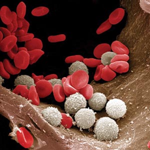 Leukemia is caused by genes