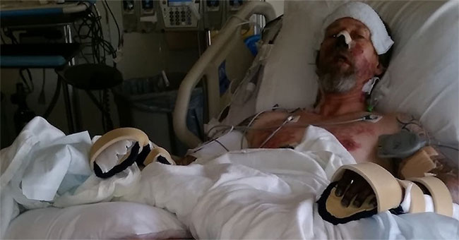 Licked by the dog, the man had to cut both his legs and arms