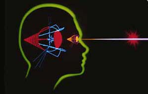 Life in the eyes of myopia
