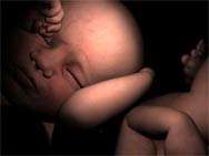 Life with multiple pregnancies in the womb