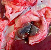 List of types of vegetables to help the fluke nest in the body