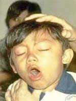 Long-term cough in children