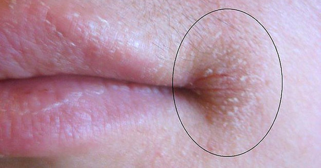 Look at the edge and see this, it's a sign your body is