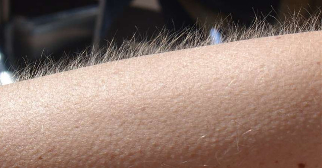 Look for the reason why some people get goose bumps when listening to music, others don't