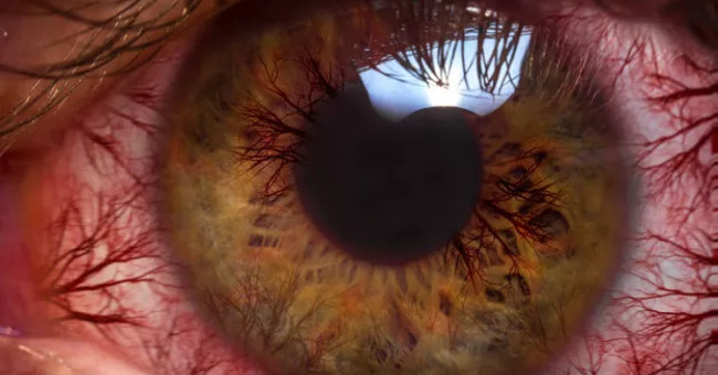 Looking at the microwave makes your eyes look like this?