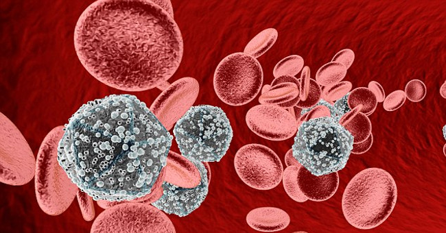 Looking for a radical cure for HIV / AIDS?