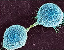 Machine 'sniffs' skin cancer
