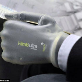 Magic i-limb ultra hands