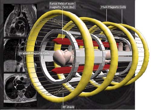 Magnetic resonance device reaches 90 nm resolution