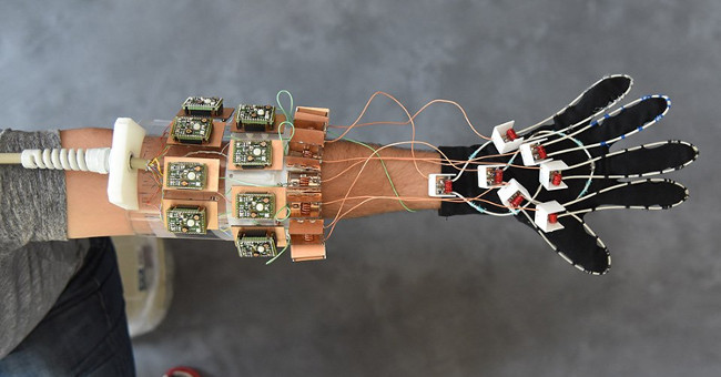 Magnetic Resonance Gloves: A development for hand surgery