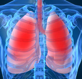 Major threat of chronic obstructive pulmonary disease