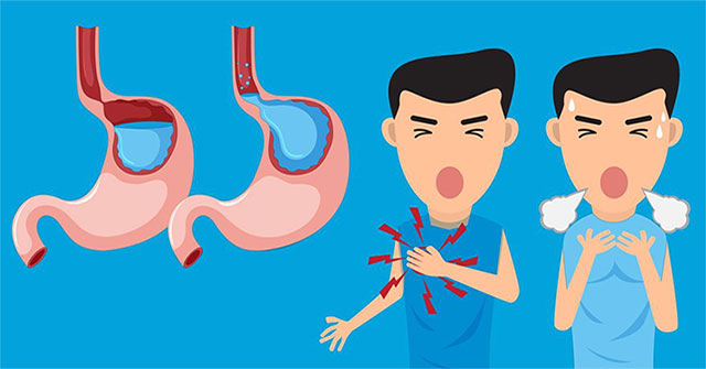 Make lifestyle changes to combat gastroesophageal reflux disease