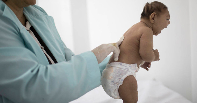 Make sure Zika virus causes brain atrophy