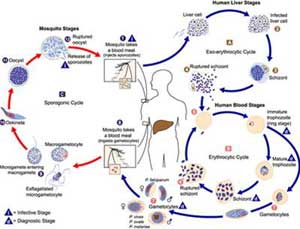 Malaria in children