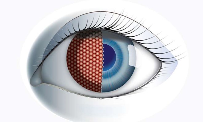 Man-made fly-eye treatment for unmanned aerial vehicles