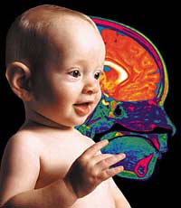 Many babies with meningitis