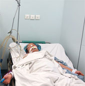 Many cases of H1N1 serious complications