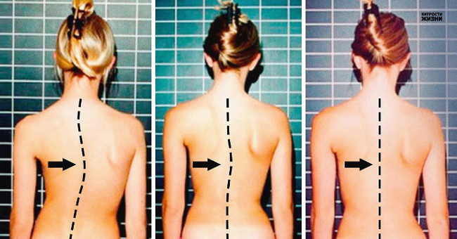 Many people working on the computer must know these 7 exercises for the spine