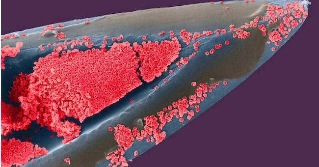 Marvel at 35 familiar images that become incredibly bizarre under a microscope
