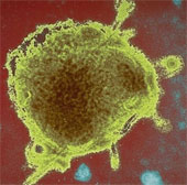 Measles virus can cure cancer?