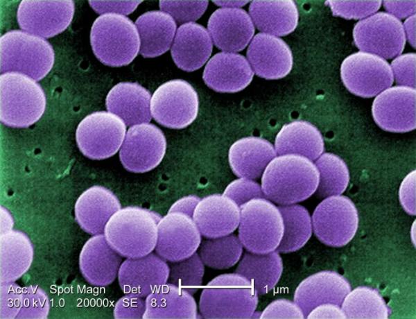 Mechanism of resistance to many bacterial drugs