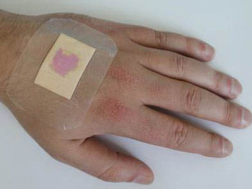 Medical Smart Tape
