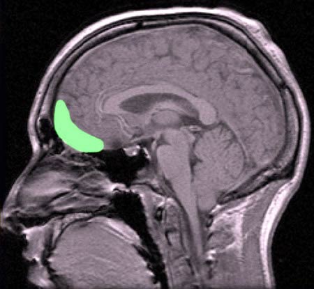 Meditation can increase gray matter