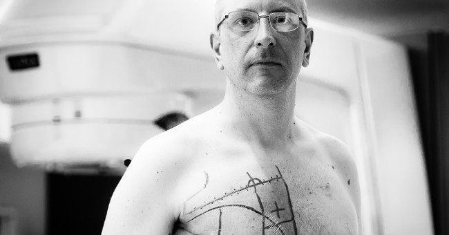 Men are more likely to die if they have breast cancer