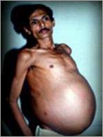 Men are pregnant