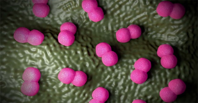 Meningococcal disease quickly kills the patient's life