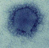MERS virus has been transmitted from animals to humans